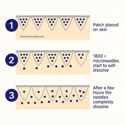 Microneedle Patches